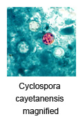 Cyclospora Water Filter